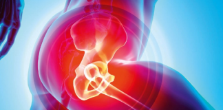 Kök Hücre İle Kalça Eklemi Tedavisi Nasıl Olur?