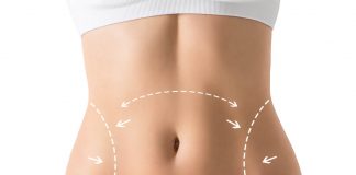 Karın Germe Ameliyatı